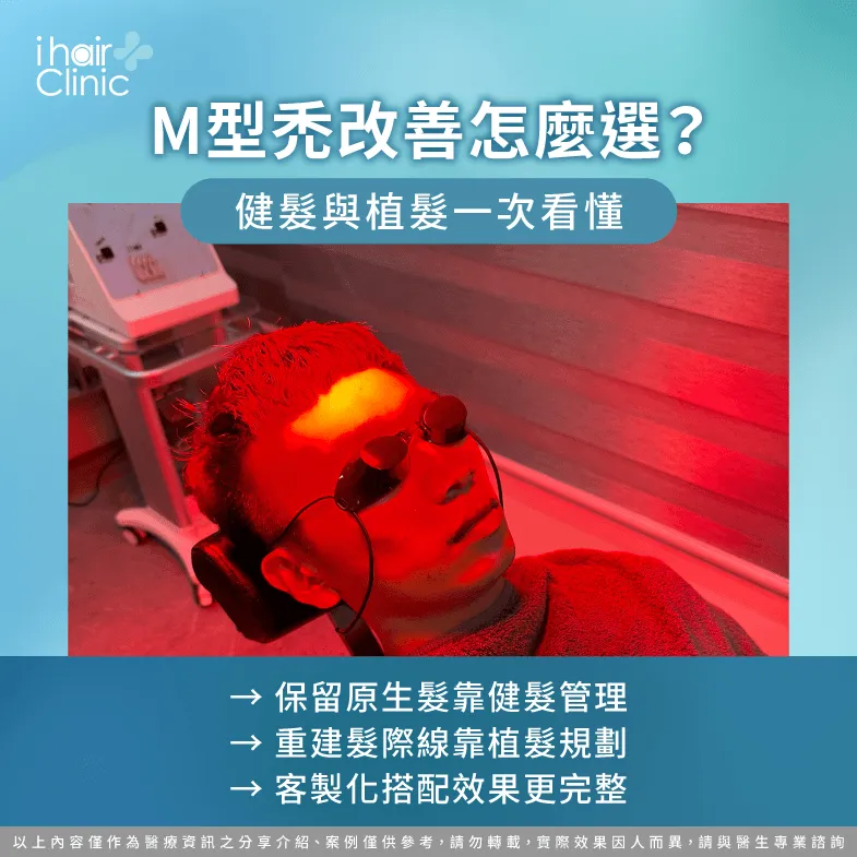 健髮還是植髮?M型禿改善方式完整解析 M型禿改善怎麼選-M型禿可以恢復嗎