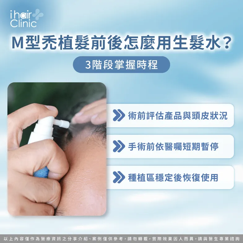 M型禿植髮前要停生髮水嗎?3階段掌握停用與恢復時程 植髮前生髮水停多久-M型禿植髮前要停生髮水嗎