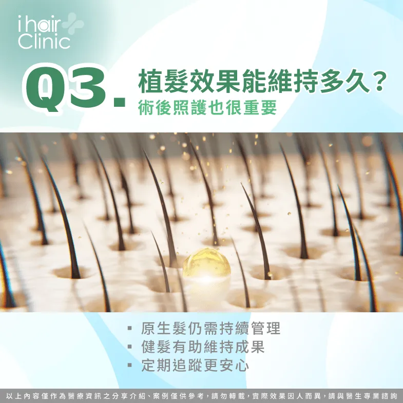 植髮效果能維持多久?術後健髮與照護重點解析 植髮維持多久-M型禿植髮 問醫生