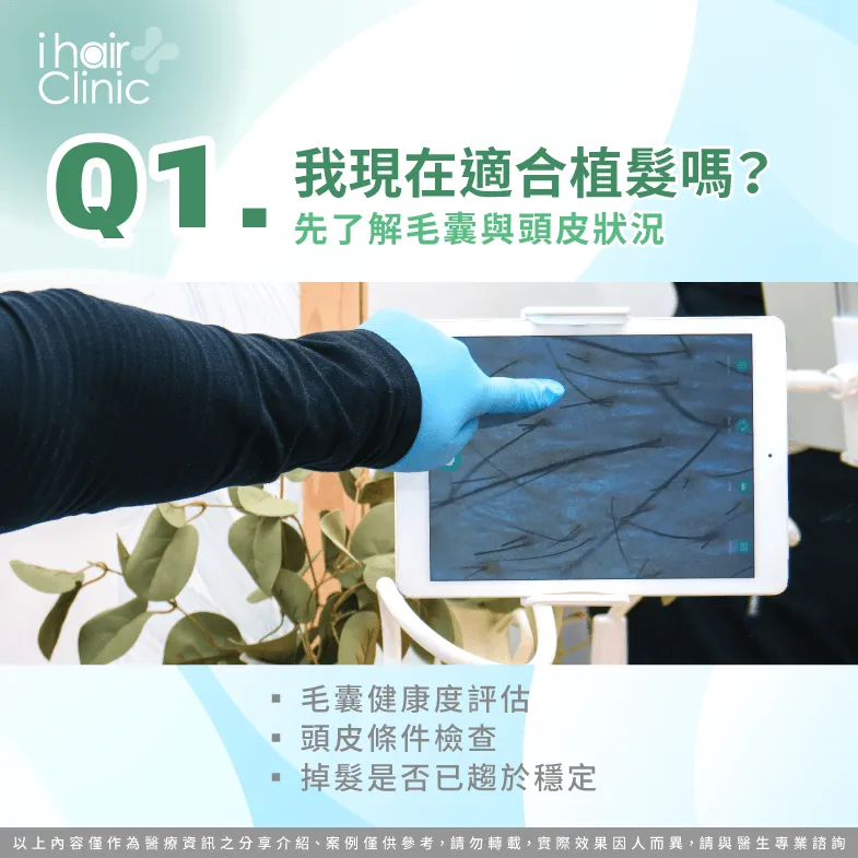 M型禿適合植髮嗎?毛囊與頭皮狀況評估重點 現在適合植髮嗎-M型禿植髮 問醫生
