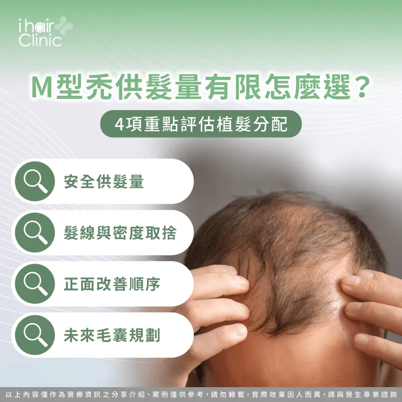 M型禿供髮量有限怎麼植?4項條件規劃毛囊分配 M型禿供髮量不足-M型禿供髮量有限