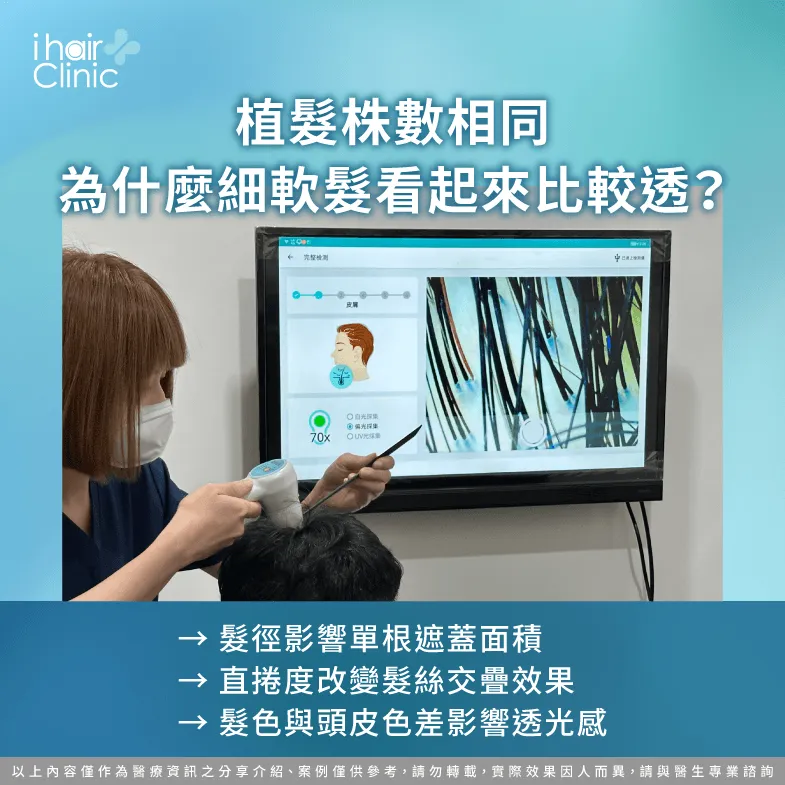 細軟髮植髮為何容易透光?髮徑、捲度與色差3項影響 髮質與透光感-細軟髮M型禿植髮