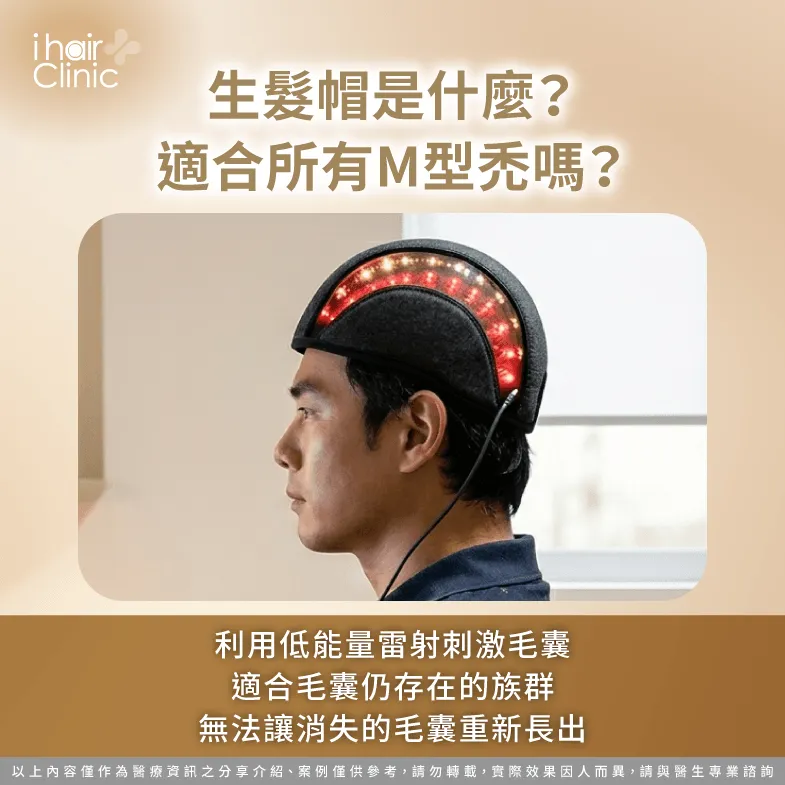 生髮帽真的有效嗎?適用族群與限制解析 生髮帽是什麼-M型禿植髮 生髮帽 比較