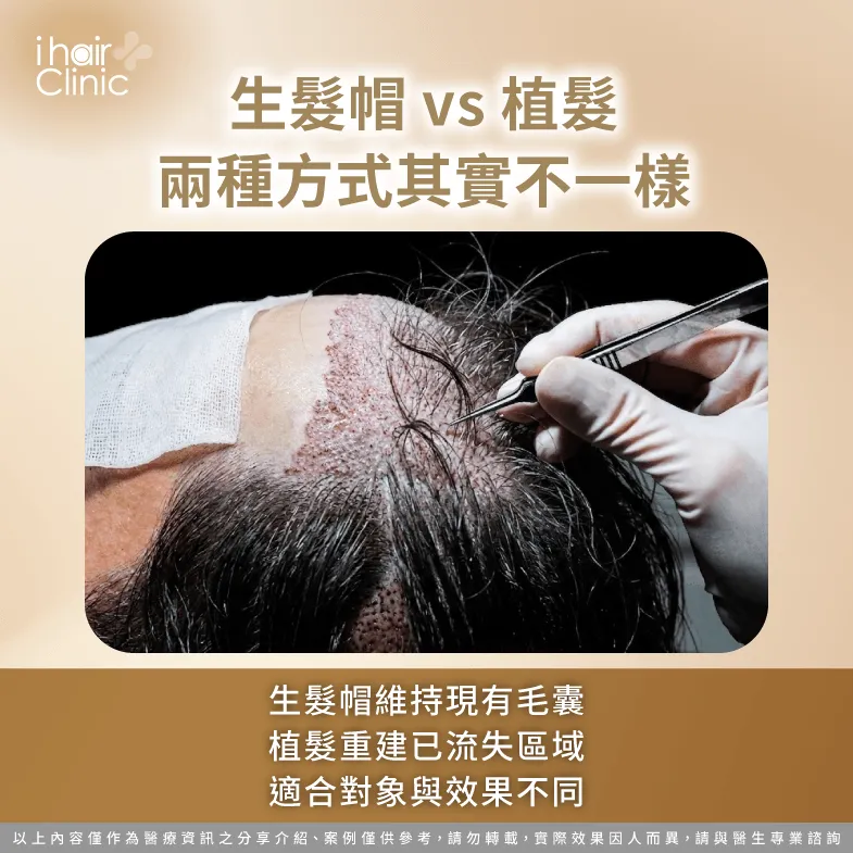 同樣是改善掉髮,生髮帽與植髮差很多 M型禿植髮 生髮帽-M型禿植髮 生髮帽 比較