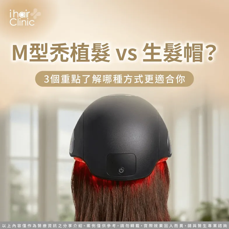 M型禿植髮 vs 生髮帽?3個重點了解哪種方式更適合你 M型禿植髮 生髮帽 比較-M型禿植髮 生髮帽