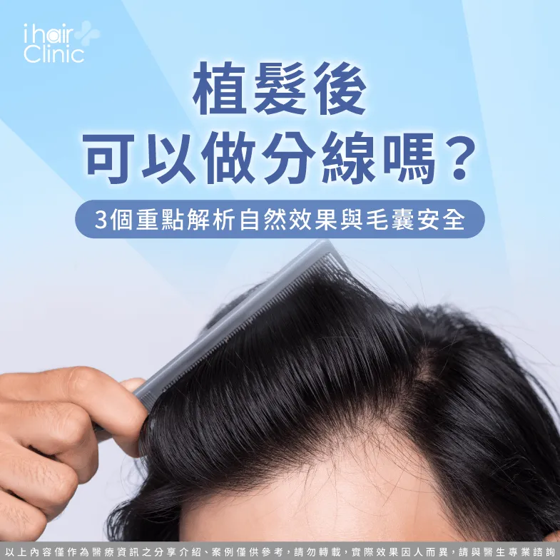 植髮後可以做分線嗎-植髮 分線