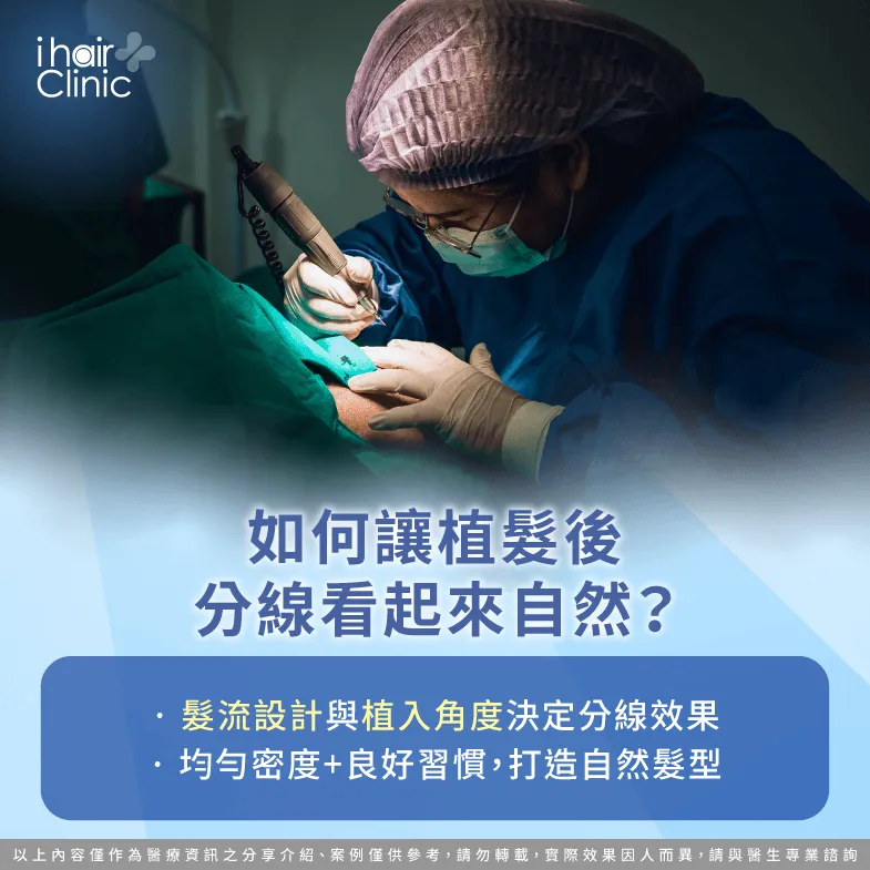 植髮後如何自然分線-植髮 分線