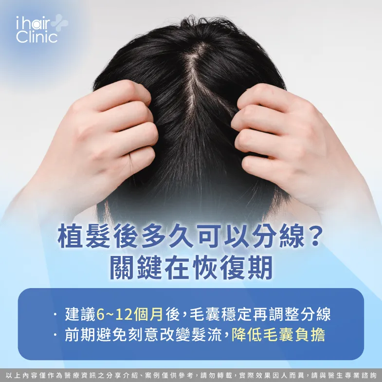 植髮後多久可以分線-植髮 分線