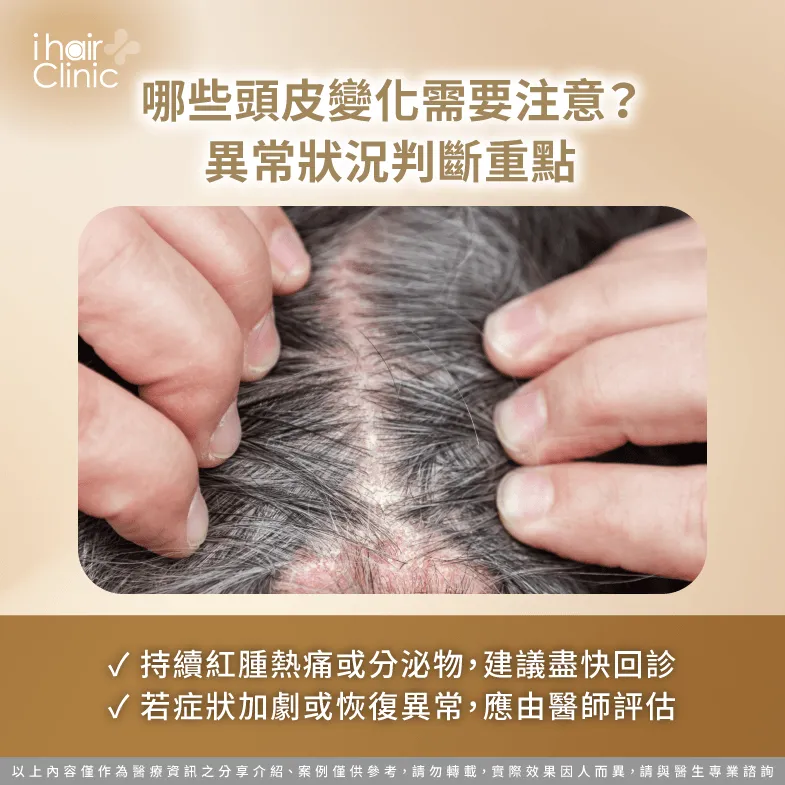 植髮後哪些頭皮變化要注意?異常狀況解析 異常狀況解析-植髮後頭皮摸起來硬硬的