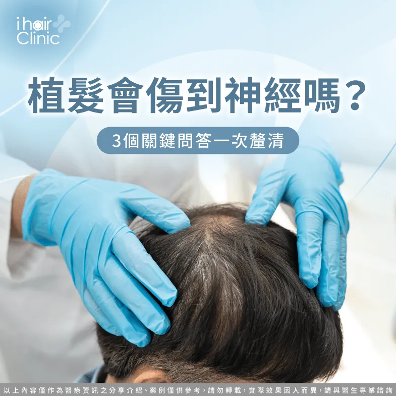 植髮會傷到神經嗎-植髮 神經
