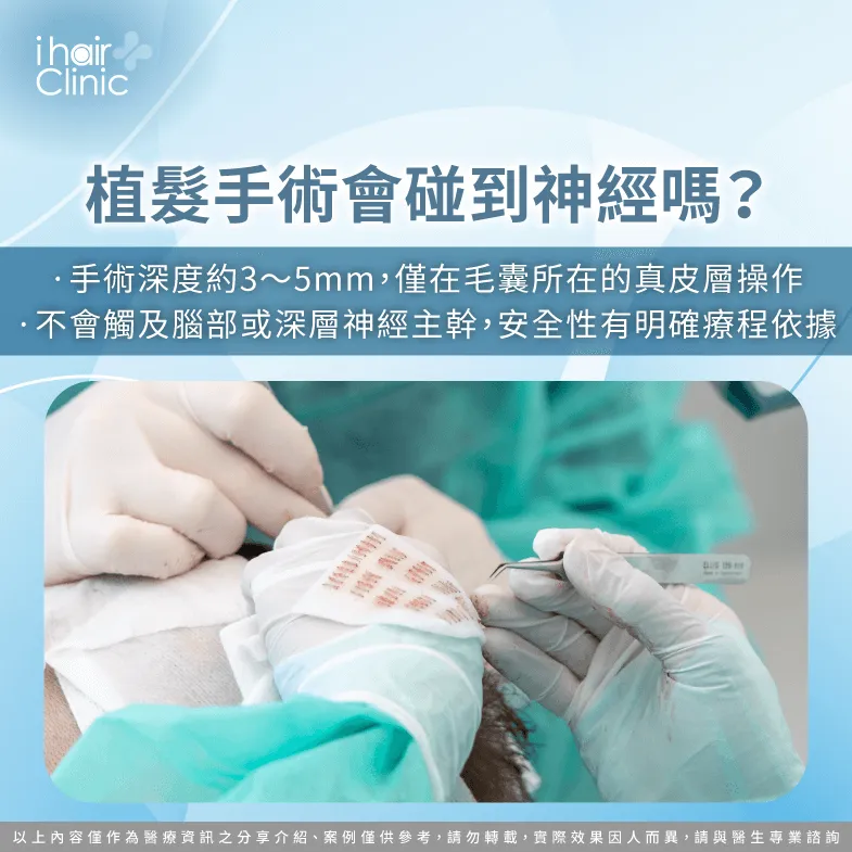 植髮會觸碰到神經嗎-植髮會傷到神經嗎