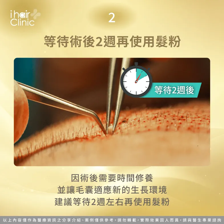 建議植髮手術完成後,等待約2週左右讓毛囊穩固後,再使用髮粉進行修飾 需要等待毛囊穩固後再使用髮粉-植髮 髮粉