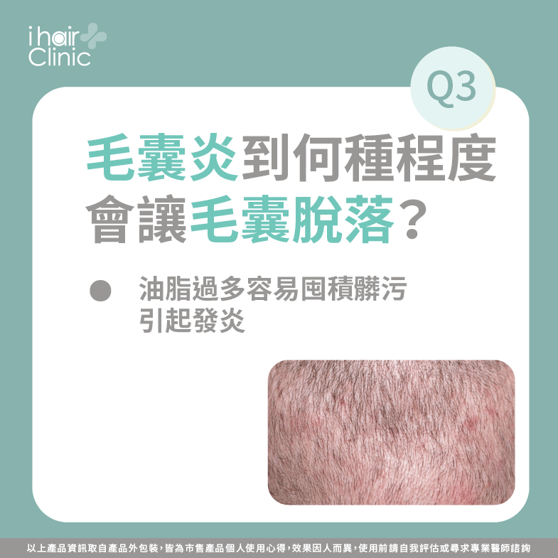 毛囊炎會掉髮嗎-頭皮油掉髮