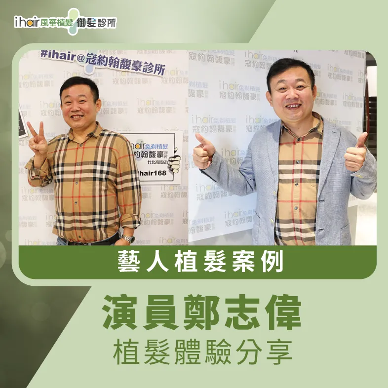 演員鄭志偉男性植髮體驗-男性植髮