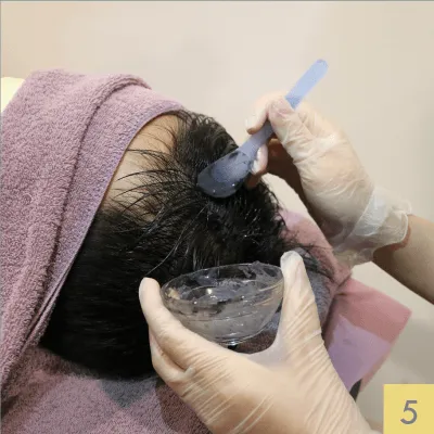 醫療光健髮步驟-台南健髮推薦