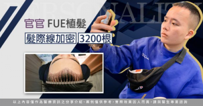 官官FUE3200根-台南植髮推薦