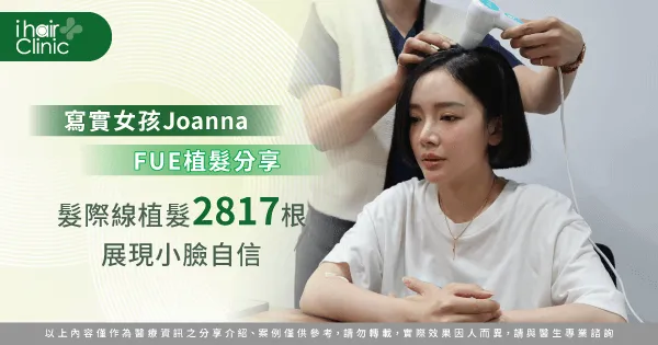 女性植髮際線-台南女性植髮推薦