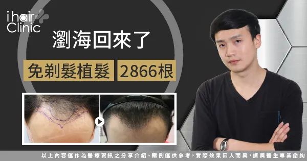 免剃髮植髮-台南植髮推薦