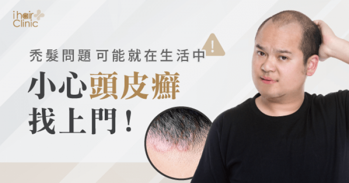頭皮癬禿頭-台北植髮診所推薦