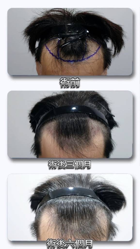 林** 評論照片