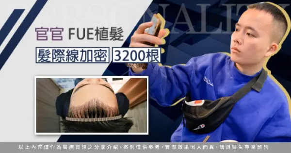 官官FUE3200根-台北植髮推薦