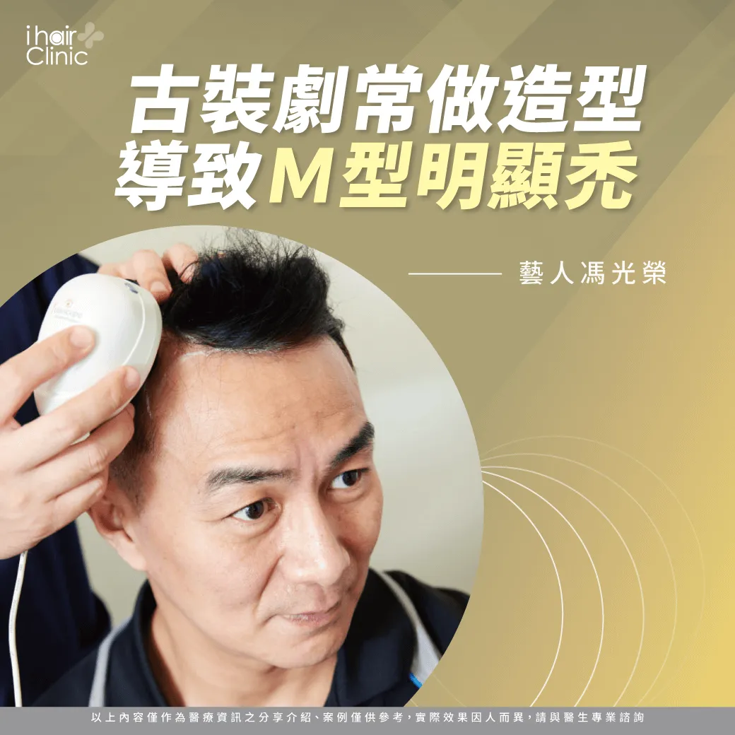 藝人馮光榮在同學會期間發現到自己的落髮狀況,因而開始正視自己的頂上毛髮! 藝人植髮-植髮推薦