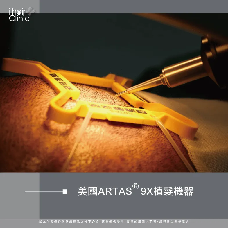 美國ARTAS9X植髮機器-台北植髮診所推薦