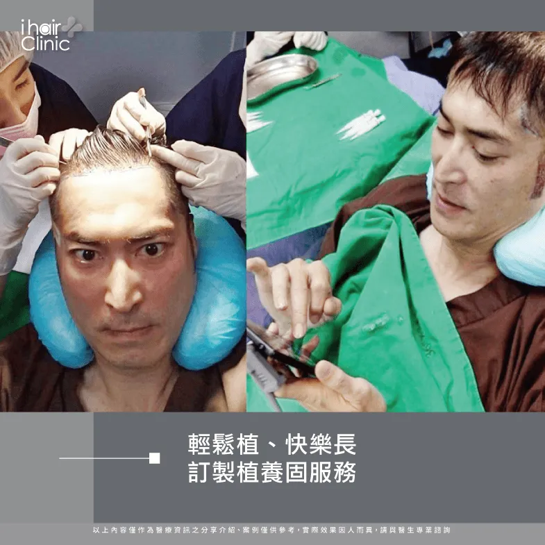 植養護一條龍服務-台北植髮診所推薦