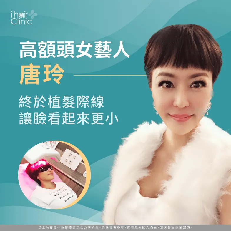 女星唐玲的藝人植髮體驗分享帶你看,化解高額頭困擾 女星唐玲的植髮體驗分享-藝人植髮