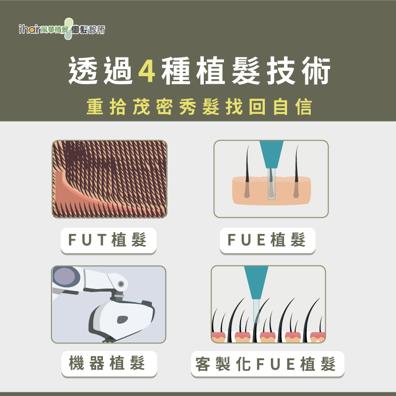 一次帶你了解4種不同的植髮技術 4種植髮技術-植髮年齡