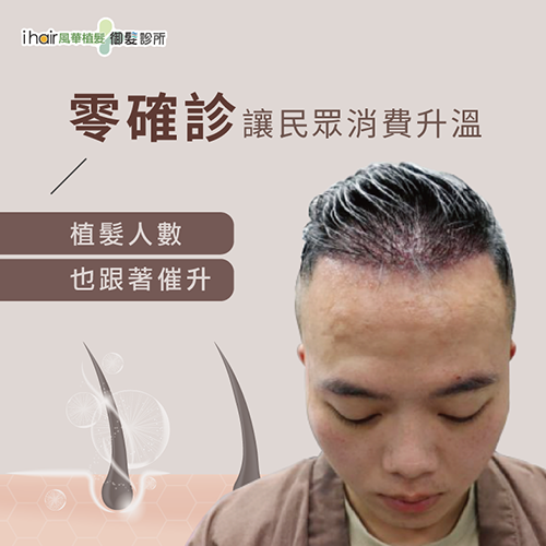 植髮是禿髮族維持好形象的最佳選擇,當天植髮、隔天即可上班,讓你擁有茂盛髮量! 男性雄性禿-台北植髮推薦