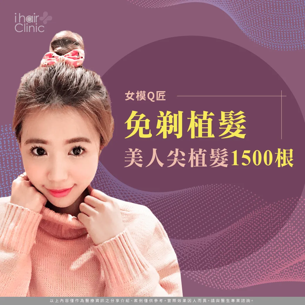 美型植髮案例-免剃植髮