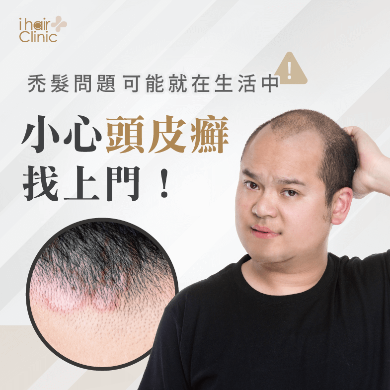 落髮問題嚴重,有可能是頭皮癬找上門,馬上看消息內容了解更多 頭皮癬禿頭怎麼辦-台北植髮診所推薦