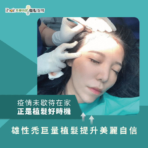 利用疫情長假做雄性禿植髮,不僅改變額頭高度,還能搭配健髮養護來美化頭皮 雄性禿額頭植髮-台北植髮推薦