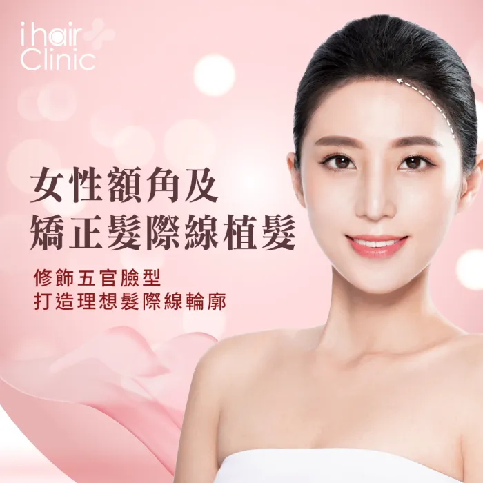 女性髮際線植髮-桃園美型髮際線