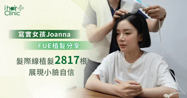 女性植髮際線-桃園女性植髮推薦